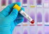 DNA Ancestry: Exploring the Roots of Our Heritage